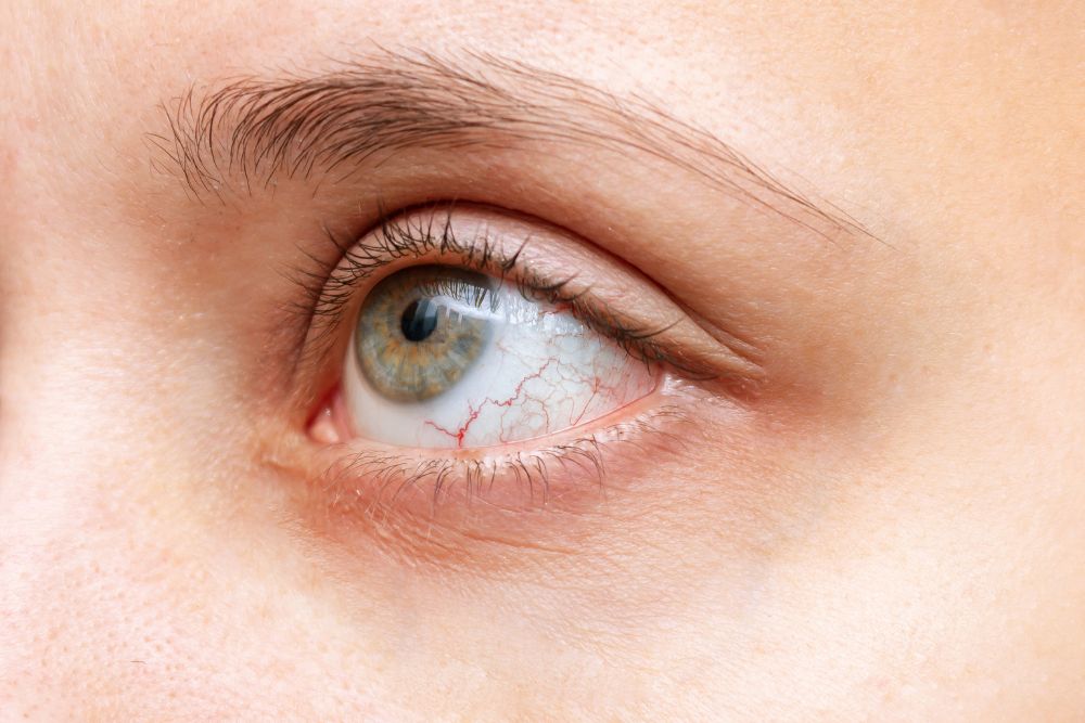 trec uveitis and autoimmune diseases